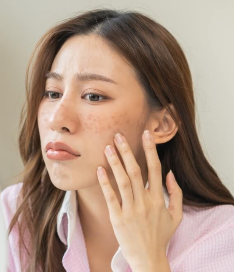 Skin barrier assessment at Dr Liza Clinic