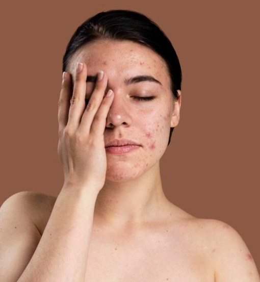 Reactive skin concern
